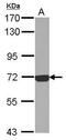 Complement C9 antibody, PA5-29066, Invitrogen Antibodies, Western Blot image 
