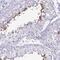 Chromosome 4 Open Reading Frame 33 antibody, PA5-63930, Invitrogen Antibodies, Immunohistochemistry paraffin image 