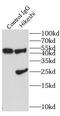 Heat Shock Protein Nuclear Import Factor Hikeshi antibody, FNab03863, FineTest, Immunoprecipitation image 