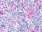 Chemerin Chemokine-Like Receptor 1 antibody, LS-A448, Lifespan Biosciences, Immunohistochemistry paraffin image 