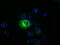 MAGUK p55 subfamily member 3 antibody, M11924-1, Boster Biological Technology, Immunofluorescence image 