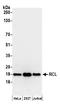 Deoxyribonucleoside 5 -monophosphate N-glycosidase antibody, A304-681A, Bethyl Labs, Western Blot image 