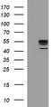 Matrix Metallopeptidase 13 antibody, TA506689BM, Origene, Western Blot image 