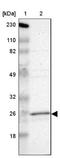 RAB9A, Member RAS Oncogene Family antibody, NBP1-87172, Novus Biologicals, Western Blot image 
