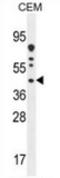 DnaJ Heat Shock Protein Family (Hsp40) Member C22 antibody, AP51293PU-N, Origene, Western Blot image 