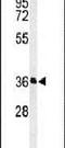 Proteasomal ATPase Associated Factor 1 antibody, PA5-24984, Invitrogen Antibodies, Western Blot image 