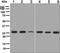 Caseinolytic Mitochondrial Matrix Peptidase Proteolytic Subunit antibody, ab124822, Abcam, Western Blot image 