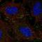 Docking Protein 5 antibody, NBP2-58486, Novus Biologicals, Immunocytochemistry image 