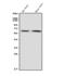 Glutamate Decarboxylase 2 antibody, M03142, Boster Biological Technology, Western Blot image 