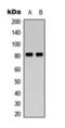 Calpain 11 antibody, orb393231, Biorbyt, Western Blot image 