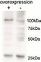 Alanyl-tRNA synthetase, mitochondrial antibody, STJ72767, St John