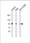 Galactosylceramidase antibody, PA5-72315, Invitrogen Antibodies, Western Blot image 