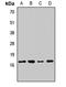 Angiotensin II Receptor Associated Protein antibody, LS-C668316, Lifespan Biosciences, Western Blot image 
