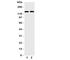 Solute Carrier Family 12 Member 6 antibody, R31292, NSJ Bioreagents, Western Blot image 