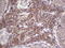 Aspartoacylase antibody, LS-C790587, Lifespan Biosciences, Immunohistochemistry paraffin image 