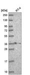 Homeobox B2 antibody, HPA047857, Atlas Antibodies, Western Blot image 