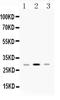 Major Histocompatibility Complex, Class II, DP Beta 1 antibody, PA5-79369, Invitrogen Antibodies, Western Blot image 