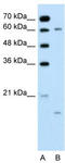 Cytochrome P450 Family 4 Subfamily A Member 22 antibody, TA346247, Origene, Western Blot image 