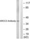 DNA repair protein XRCC3 antibody, LS-C118641, Lifespan Biosciences, Western Blot image 