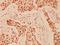 Histone Deacetylase 9 antibody, A02177, Boster Biological Technology, Immunohistochemistry paraffin image 