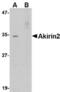Akirin 2 antibody, TA306647, Origene, Western Blot image 