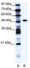 Zinc Finger Protein 541 antibody, TA329099, Origene, Western Blot image 