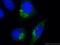 Ras-related protein Rab-27A antibody, 66058-1-Ig, Proteintech Group, Immunofluorescence image 