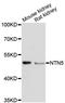 Netrin 5 antibody, LS-C748262, Lifespan Biosciences, Western Blot image 