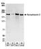 Synaptojanin 2 antibody, A303-963A, Bethyl Labs, Western Blot image 
