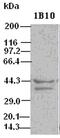 DNA Fragmentation Factor Subunit Alpha antibody, MA5-24888, Invitrogen Antibodies, Western Blot image 
