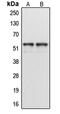 Cytochrome P450 Family 1 Subfamily A Member 1 antibody, MBS821638, MyBioSource, Western Blot image 