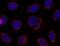 Stromal Interaction Molecule 1 antibody, LS-B1880, Lifespan Biosciences, Immunocytochemistry image 