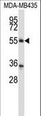 Zinc Finger Protein 222 antibody, LS-C160840, Lifespan Biosciences, Western Blot image 