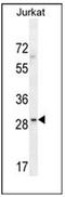 Leucine Rich Repeat Containing 25 antibody, AP52528PU-N, Origene, Western Blot image 