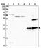 Superoxide Dismutase 3 antibody, PA5-59870, Invitrogen Antibodies, Western Blot image 