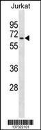Polypeptide N-Acetylgalactosaminyltransferase 14 antibody, 60-021, ProSci, Western Blot image 