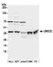 Ubiquitin Conjugating Enzyme E2 Z antibody, A304-982A, Bethyl Labs, Western Blot image 