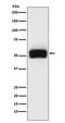 Matrix Metallopeptidase 17 antibody, M08090-1, Boster Biological Technology, Western Blot image 