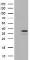 NSE2 (MMS21) Homolog, SMC5-SMC6 Complex SUMO Ligase antibody, CF501633, Origene, Western Blot image 