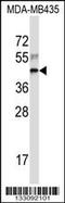 60S ribosomal protein L3 antibody, 57-031, ProSci, Western Blot image 