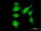 FGFR1 Oncogene Partner antibody, H00011116-M01, Novus Biologicals, Immunofluorescence image 