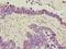 Chromosome 6 Open Reading Frame 141 antibody, A65258-100, Epigentek, Immunohistochemistry paraffin image 