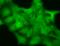 Gamma-Aminobutyric Acid Type A Receptor Delta Subunit antibody, SMC-345D-P594, StressMarq, Immunocytochemistry image 