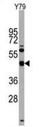 Homeobox protein TGIF1 antibody, AP14007PU-N, Origene, Western Blot image 
