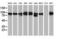 Protein Kinase C Epsilon antibody, TA502395S, Origene, Western Blot image 