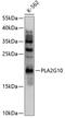 Phospholipase A2 Group X antibody, 13-537, ProSci, Western Blot image 