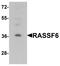 Ras Association Domain Family Member 6 antibody, TA326614, Origene, Western Blot image 