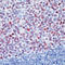 BCL6 Transcription Repressor antibody, LS-C87544, Lifespan Biosciences, Immunohistochemistry paraffin image 