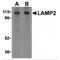 Lysosomal Associated Membrane Protein 2 antibody, TA306261, Origene, Western Blot image 