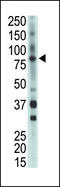 BMX Non-Receptor Tyrosine Kinase antibody, 63-157, ProSci, Western Blot image 